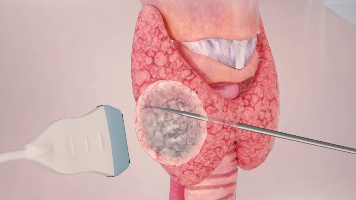 Médicos brasileiros se especializam na Coreia