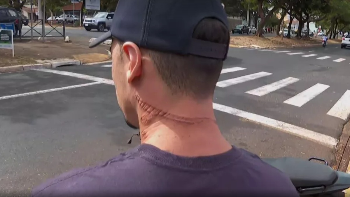 Acidente de moto 13 de Maio