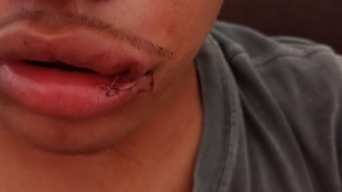 agressão a criança