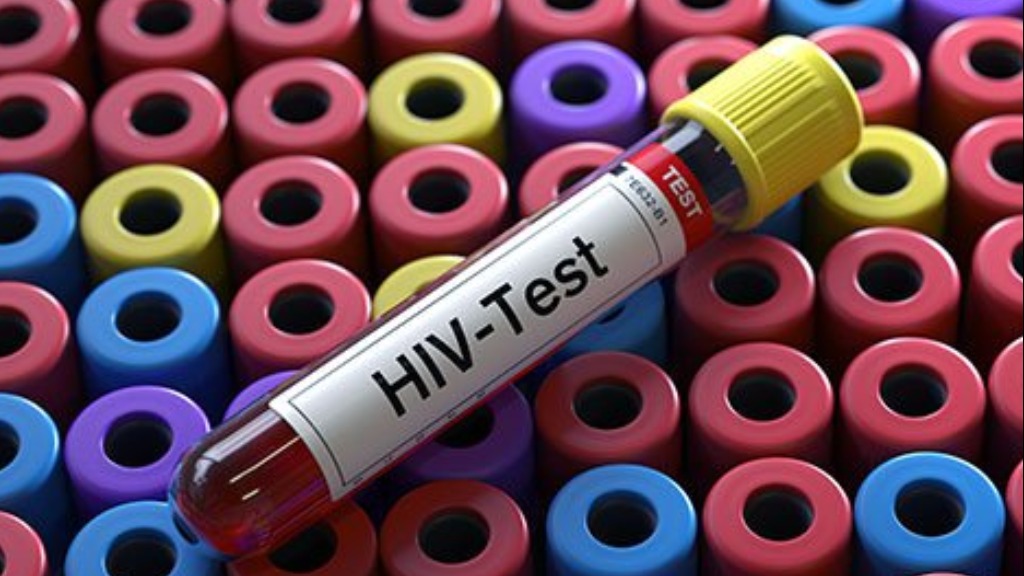 Dia Mundial de Combate à Aids