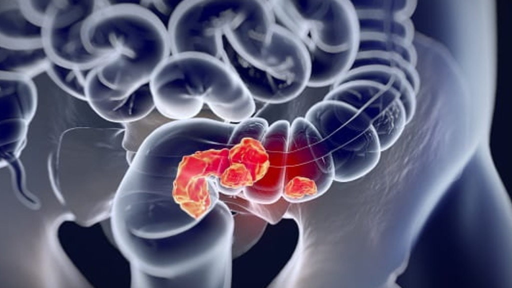 Campanha “Março Azul Marinho” busca conscientizar