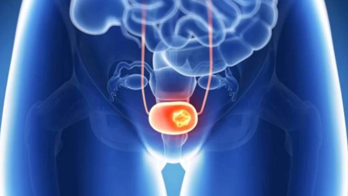 Você sabia que o uso