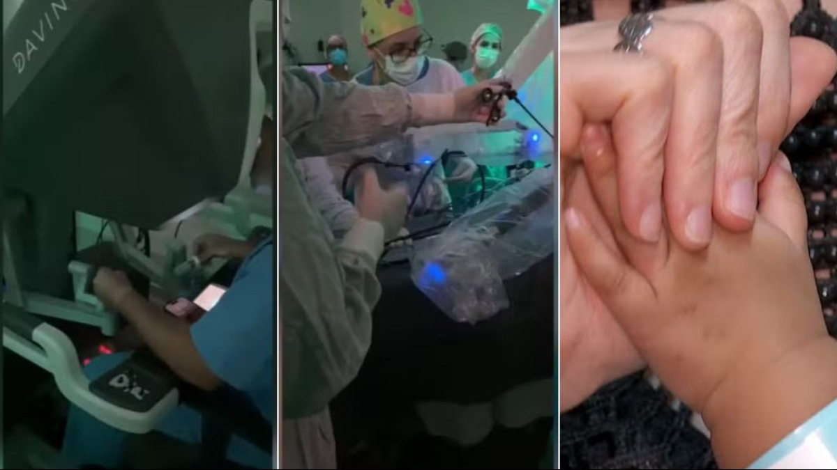 A primeira cirurgia robótica de pâncreas