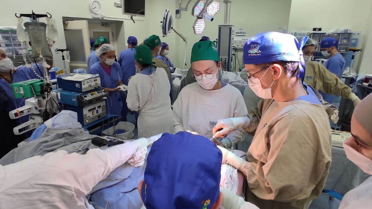 cirurgia separação siamesas