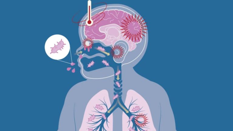 aumento de casos de coqueluche em