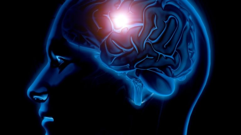 Atendimento de casos de Alzheimer crescem