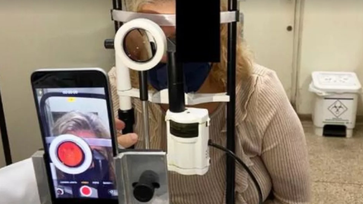 exame fundo olho celular