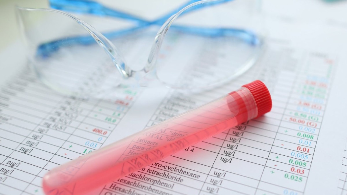 Hoje (28) é o último dia