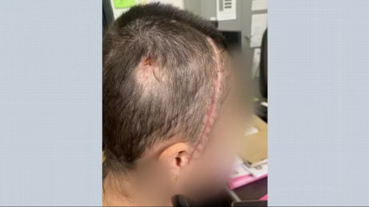 Homem é acusado de jogar mulher