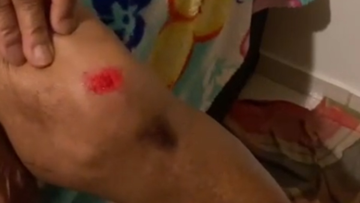 Acidente ônibus idosa