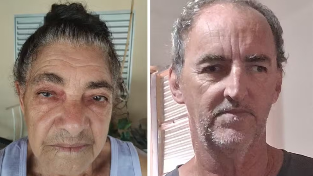 Mutirão contra a catara em Taquaritinga