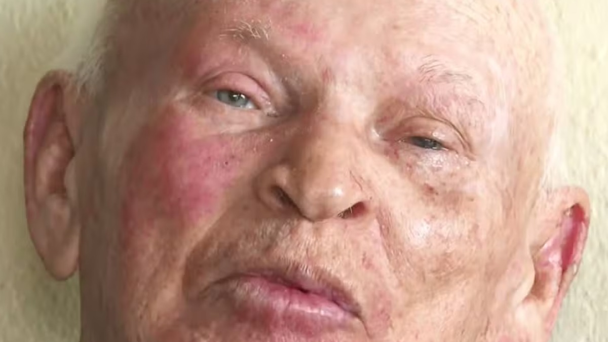 Número de pacientes que tiveram a