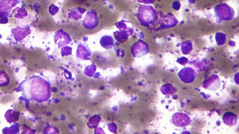 terapia car-t no brasil