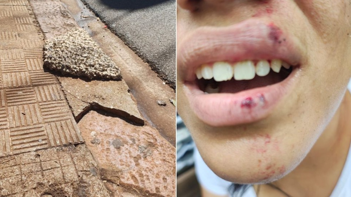 Mulher fica ferida após tropeçar em