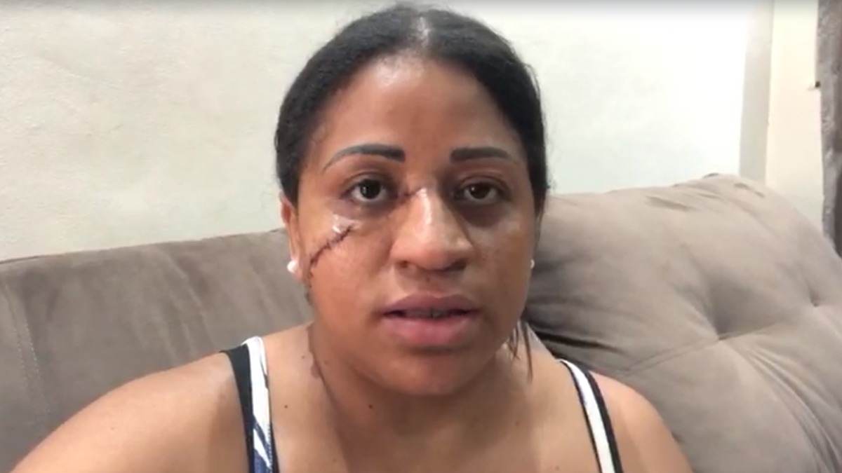 cerol em Jaboticabal