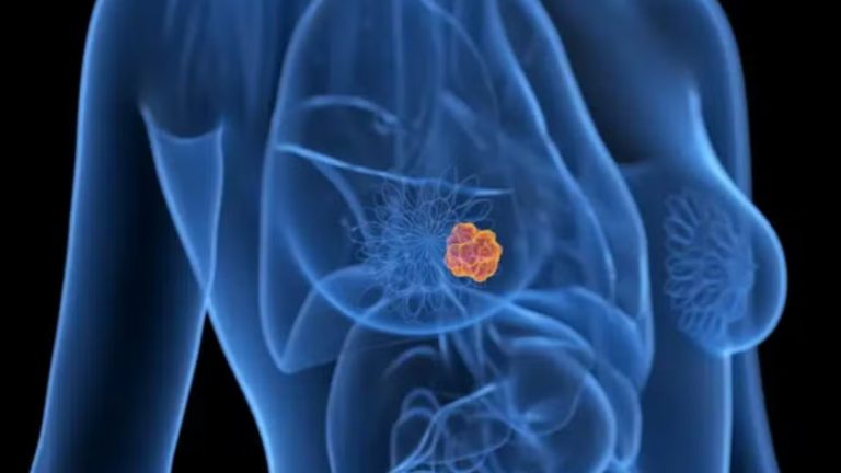 Pesquisa da USP desenvolve inteligência artificial