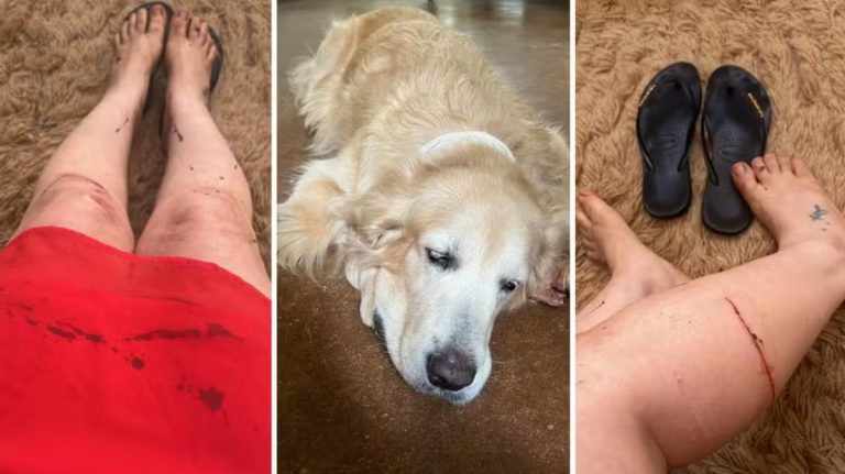 Cão da raça pitbull avança em