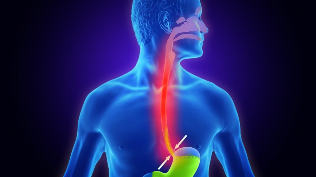 refluxo gastroesofágico