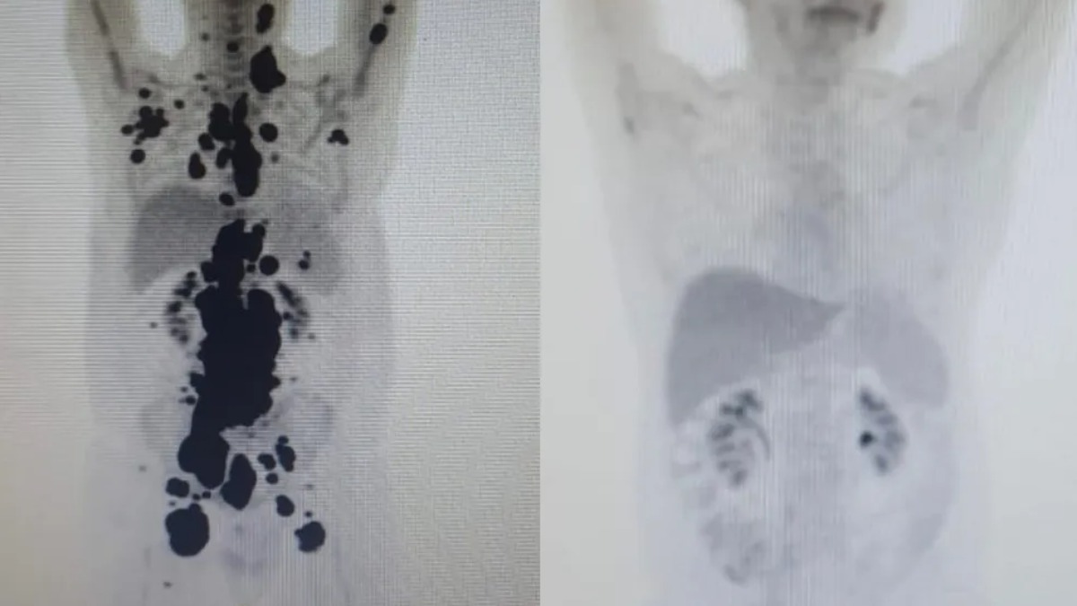 HC Ribeirão e Hemocentro iniciam os