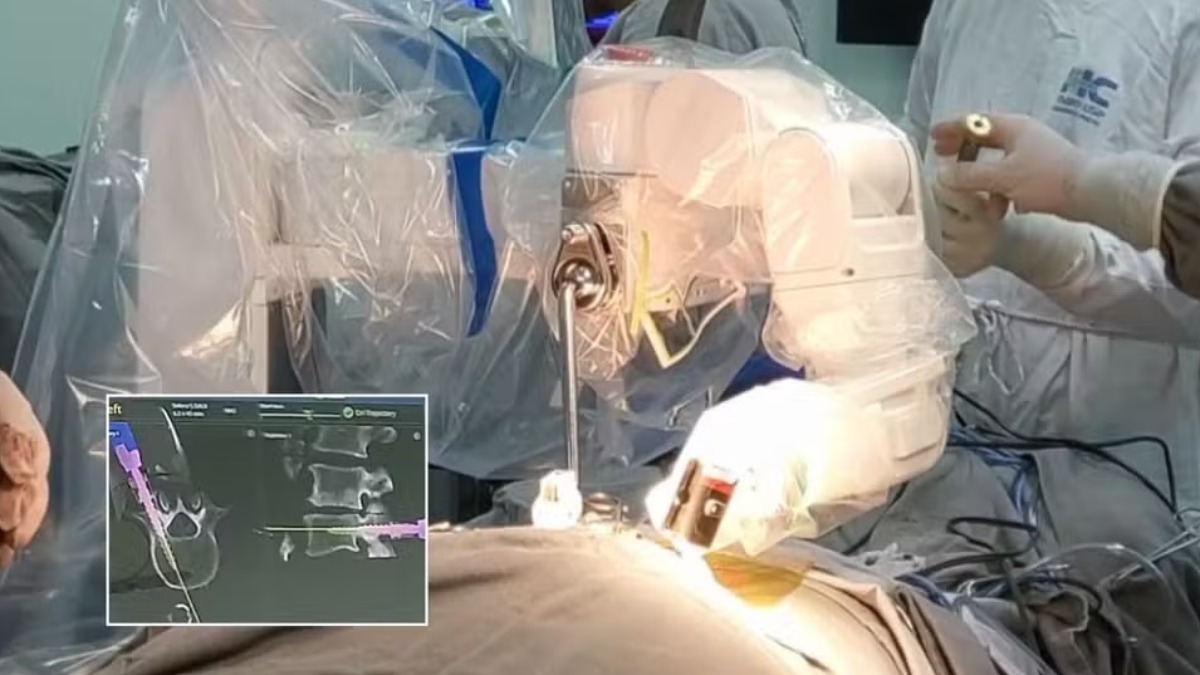 robô cirurgia coluna