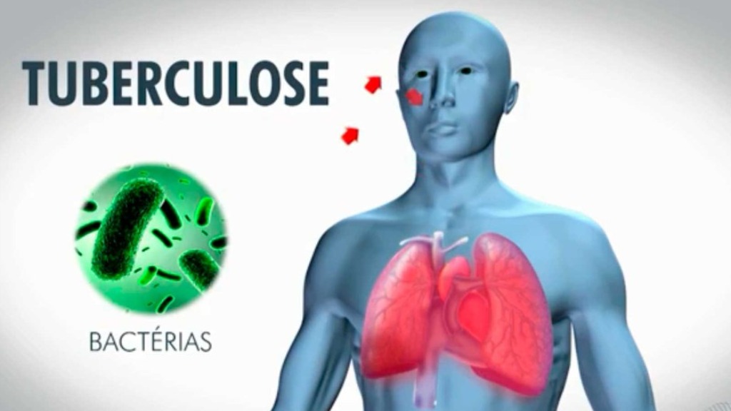 tuberculose no Brasil