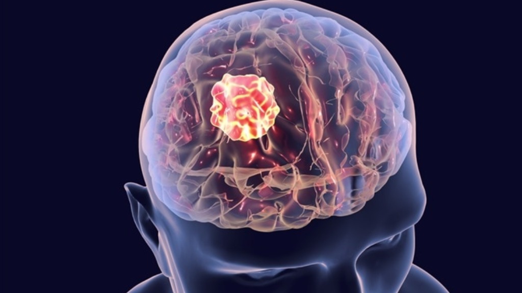 Pesquisa da Unesp de Araraquara desenvolve