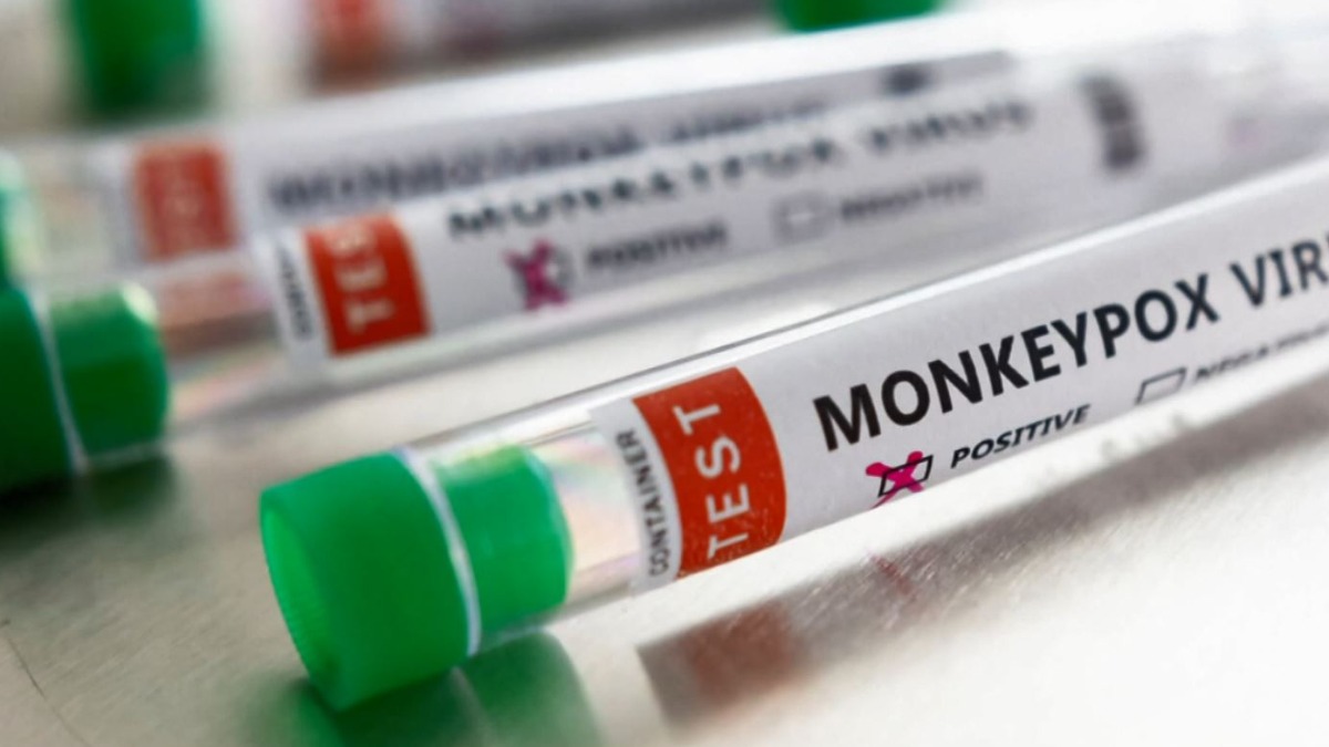 varíola dos macacos