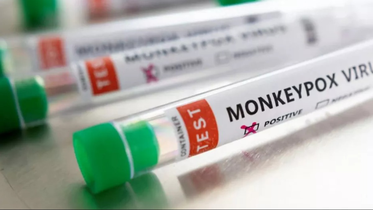 casos de MPox Ribeirão Preto