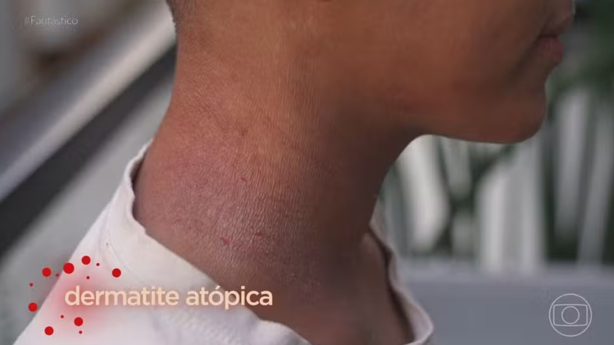 Volta às aulas pode aumentar casos