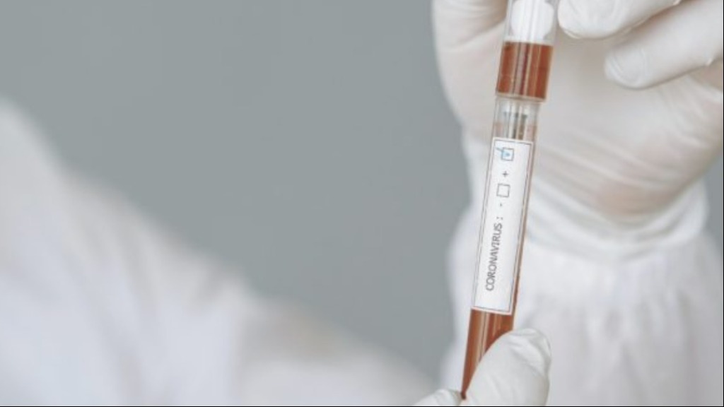 nova cepa coronavírus