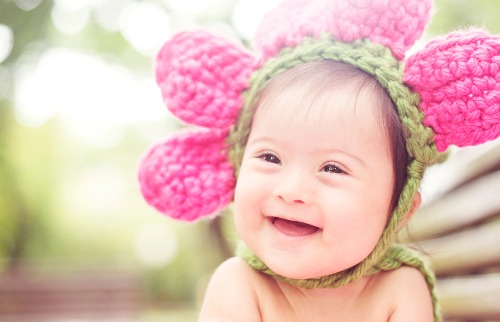 vacinação Síndrome de Down