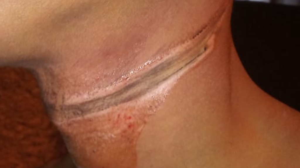 Fio de telefonia solto