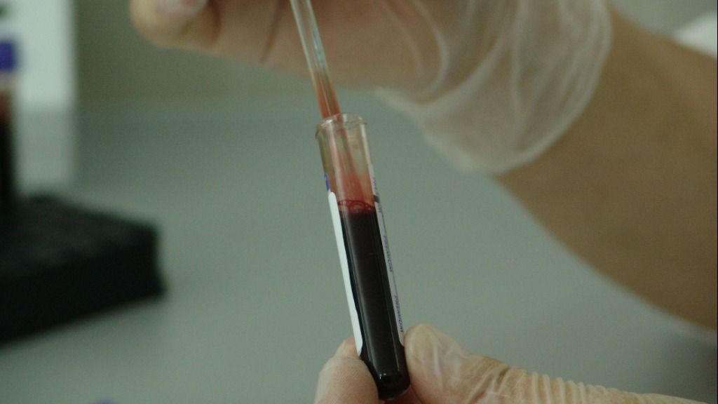 plasma convalescente Covid-19