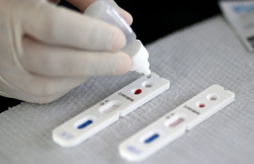 casos ativos Covid-19