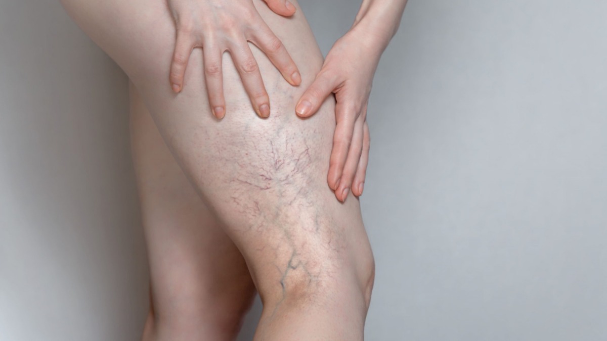 Dia Nacional Combate Trombose