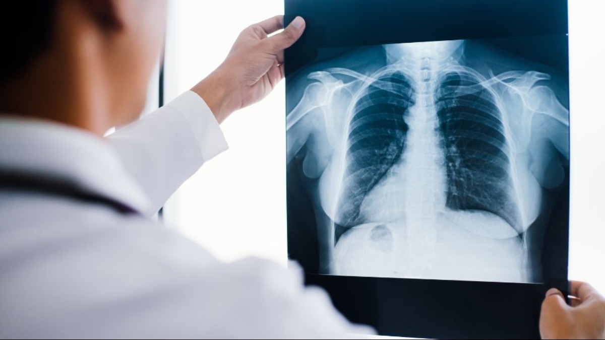 UPAs Ribeirão Preto