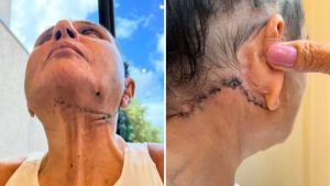 procedimentos estéticos falhos